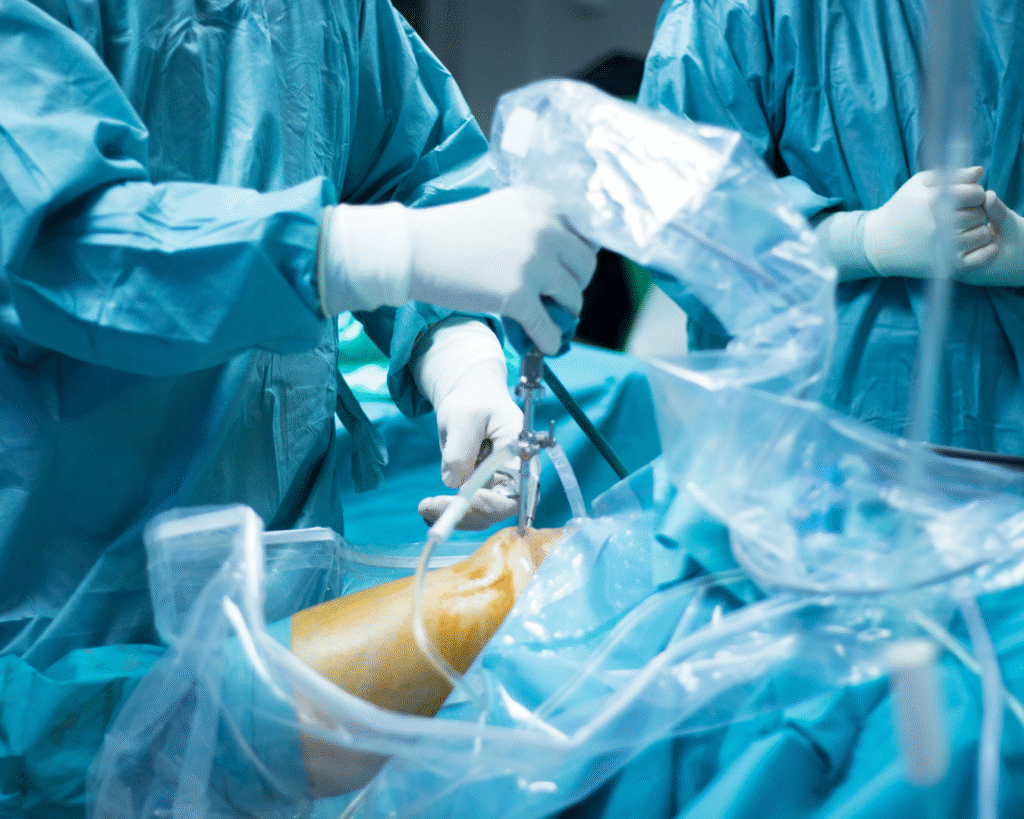 Dra. Karen Voltan realizando cirurgia oncológica ortopédica especializada no tratamento de tumores musculoesqueléticos em São Paulo.